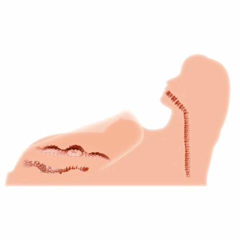 Hera 3 model anatomiczny z trzema kanałami TPR 3D Hera 3 model anatomiczny z trzema kanałami TPR 3D