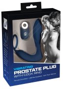 You2Toys Prostata model analny z pilotem 10 trybow wibracji czarny