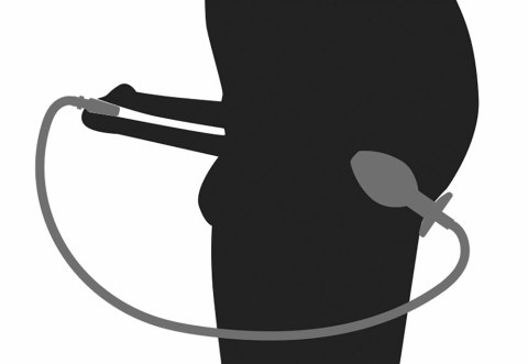 Mystim Plug & Play - Zestaw intymny ze stali nierdzewnej i silikonową rurką Mystim Plug & Play - Zestaw intymny ze stali nierdzewnej i silikonową rurką