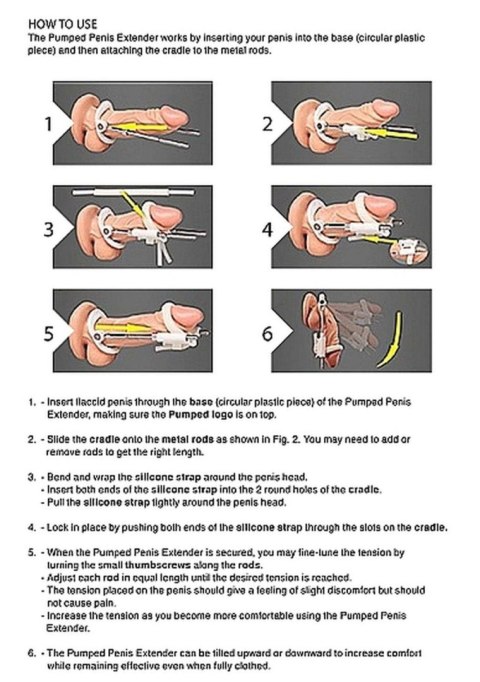 Penis Extender - White Penis Extender - White